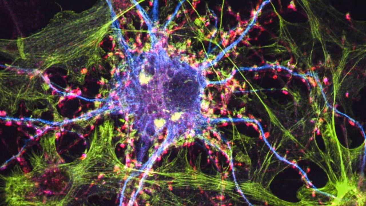 Image of nerve cells