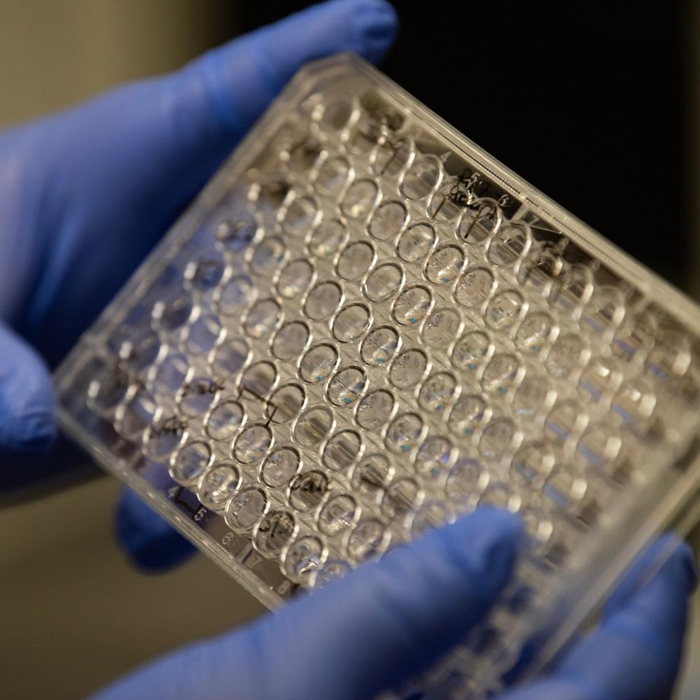 Hands holding a tray of bovine cells in the Integrative Center for Alternative Meat and Protein (iCAMP) lab.