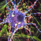 Image of nerve cells